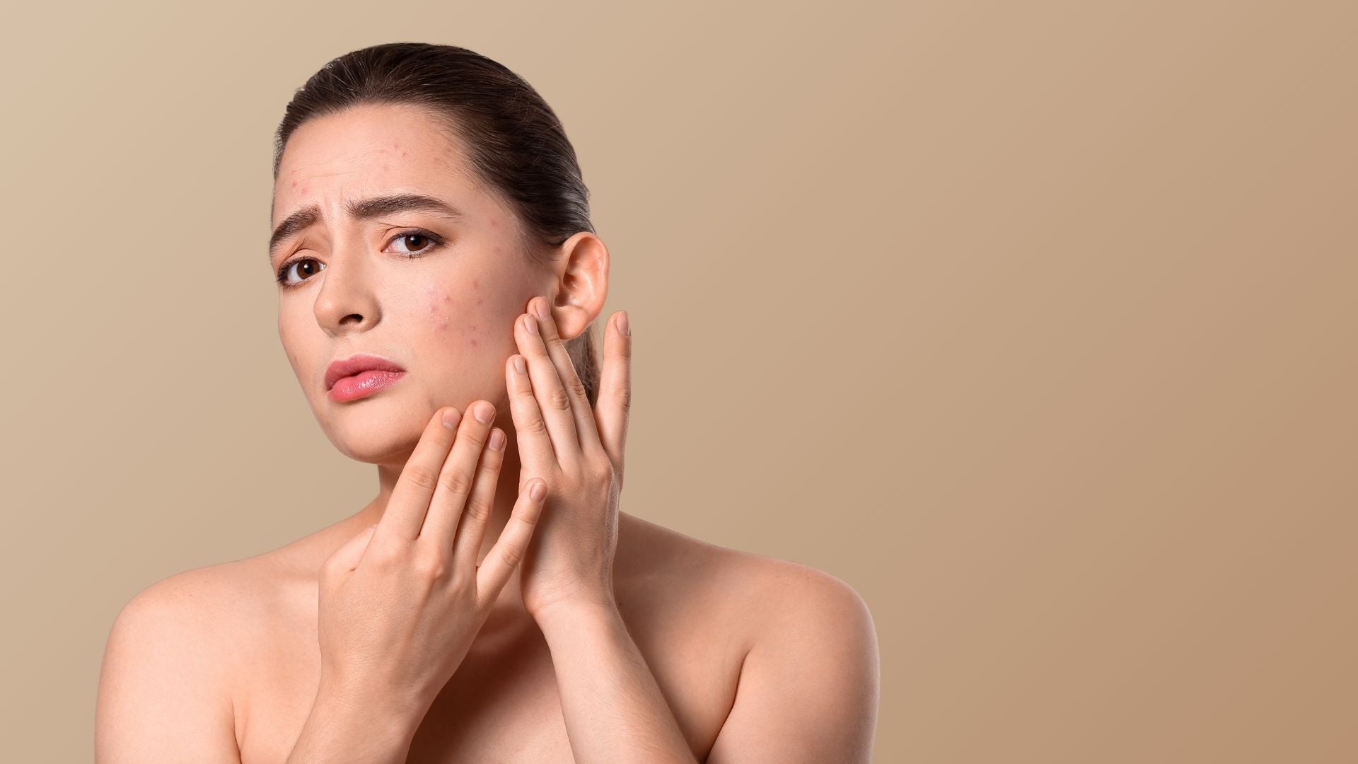 Before effect of using of BlushByEve Products 
